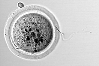 Microspy image of sperm and an egg