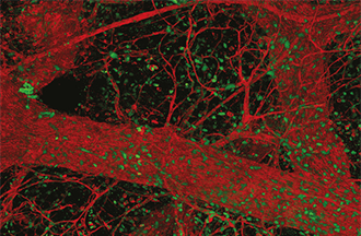 Red and green image of breast ducts