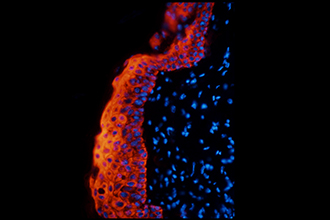 Microscope image showing inflammation