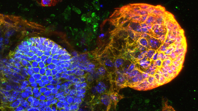 Developing intestinal buds with different colours highlighting the proteins involved in growth.