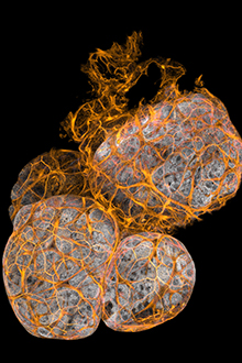 Grey and orange image of cells