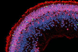 Microscopic image of retina cells coloured red, pink and blue