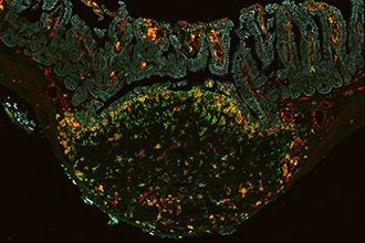 Microscope image of dendritic cells