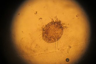 Light microscopy image of a Sarcoptes scabiei, the mite that causes scabies