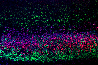 Image depicting distinct layers of the brain