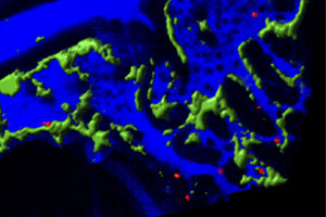 Blood cancer cells (red) hiding in bone marrow