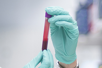 Hands holding a vial of blood