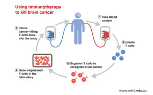 brain cancer immunotherapy infographic