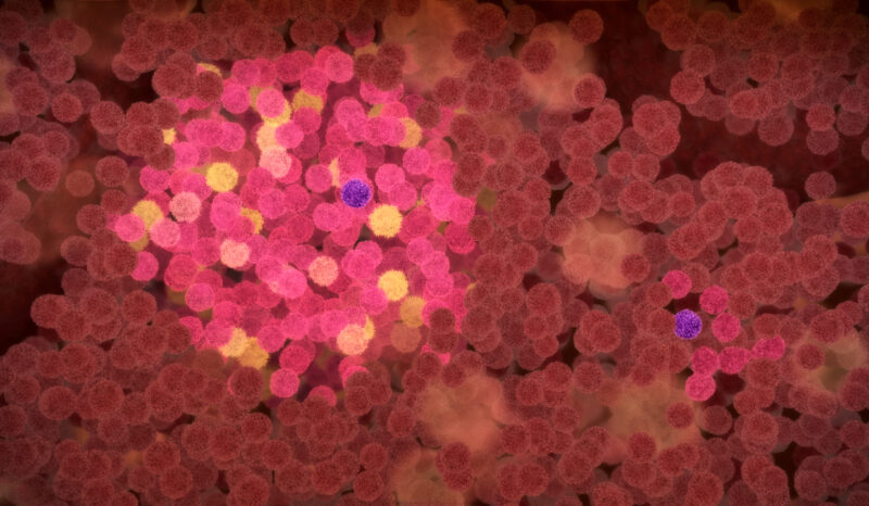 Since their discovery in 1977 by Professor Donald Metcalf and his colleagues, CSFs have helped millions of cancer patients to survive the damage to bone marrow caused by high-dose chemotherapy.