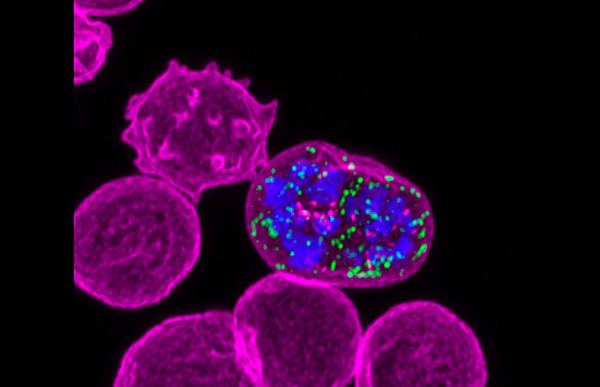 Malaria parasite infecting a blood cell