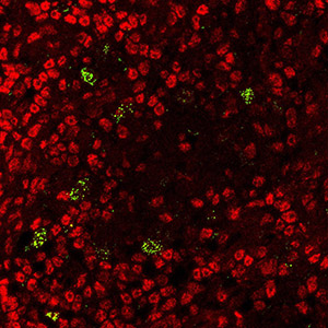 Microscope view of thymus cells making AIRE