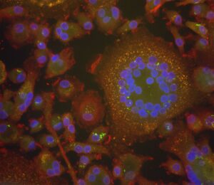 Snapshot of live cell imaging of tuberculosis