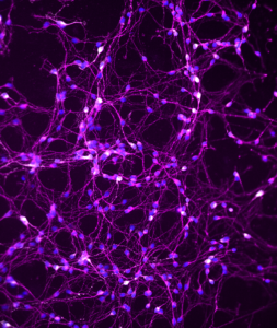 Microscope view of neurons