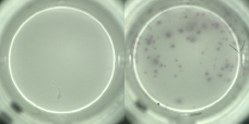 Figure 1: Testing gluten specific T cellsA. Prior to gluten challenge, no gluten specific immune cells are detectable in the blood. B. After a gluten challenge, gluten specific immune cells can be isolated and studied, providing a wealth of information.