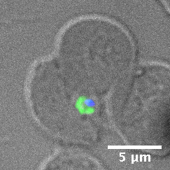 Microscope view of malaria parasite