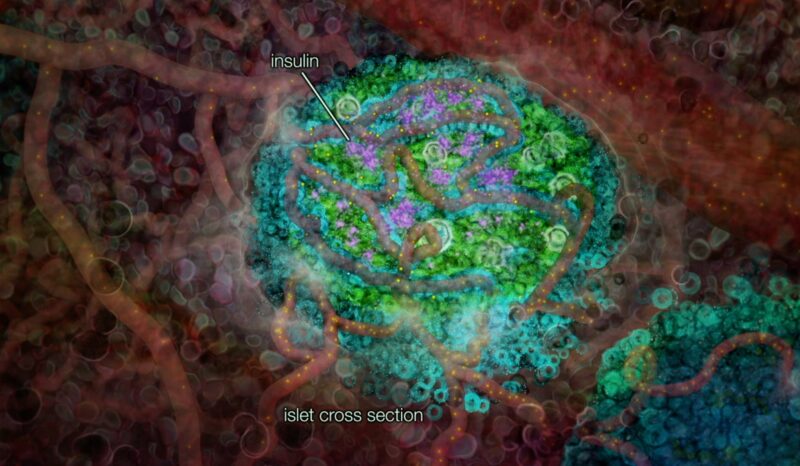 Inflammation and type 2 diabetes animation still