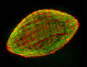 Scientific image of malaria