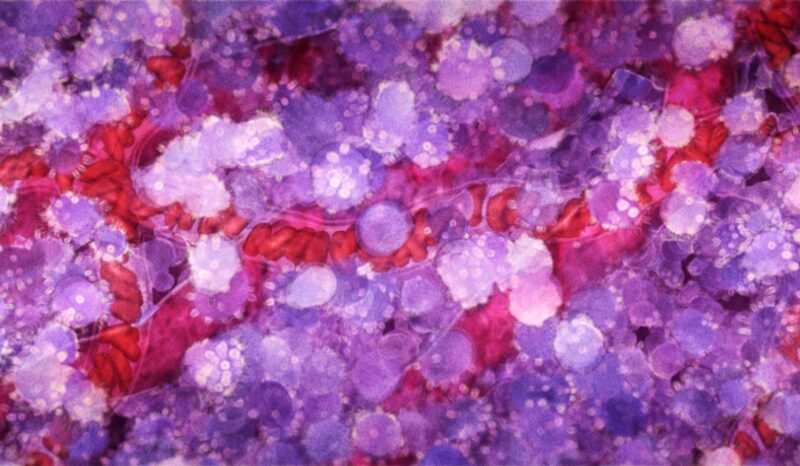 Transection through cell tissue.