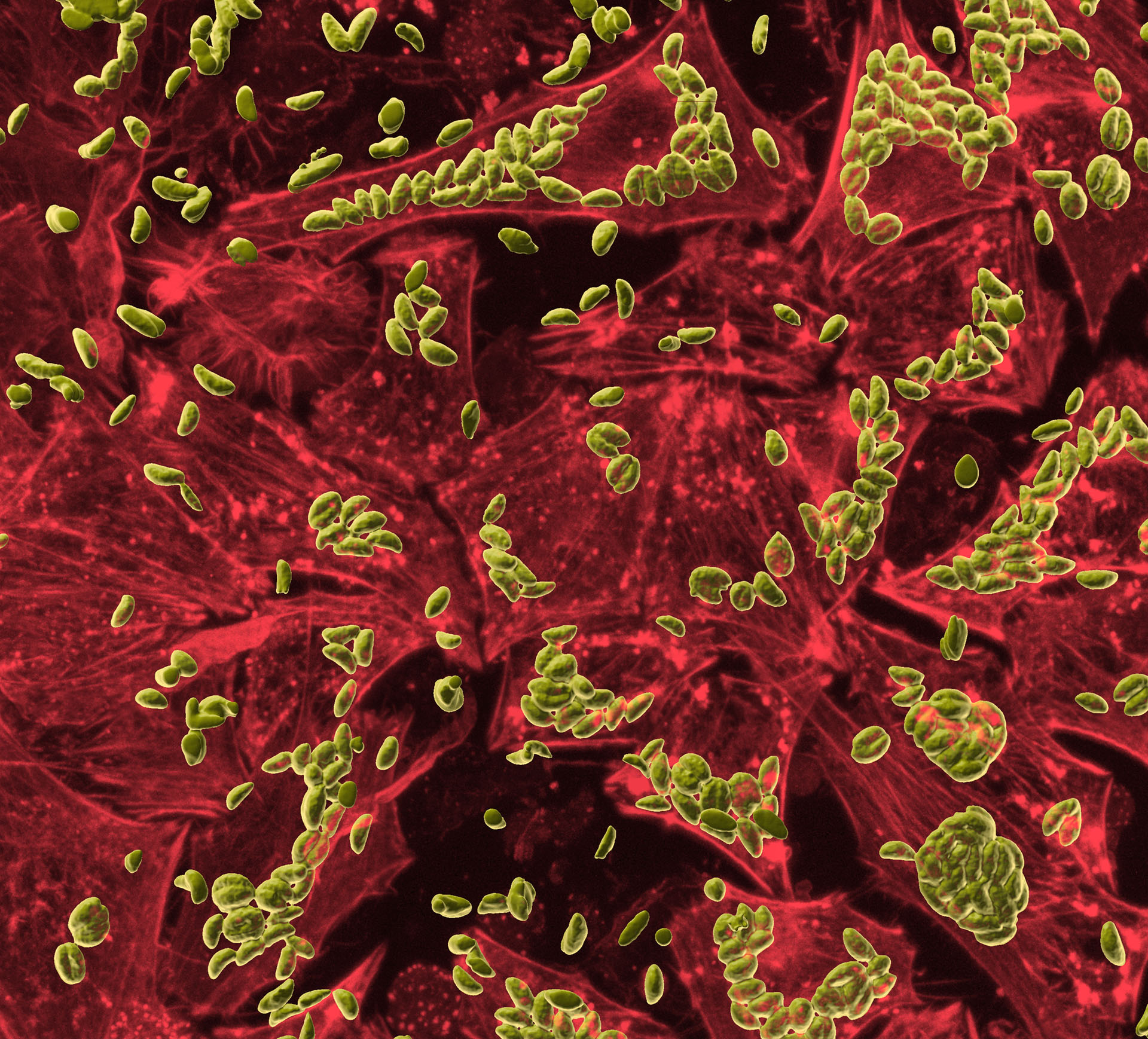 Toxo Actin' Chill - Aurelie Dawson, Caleb Dawson, Cindy Evelyn Art of Science submission