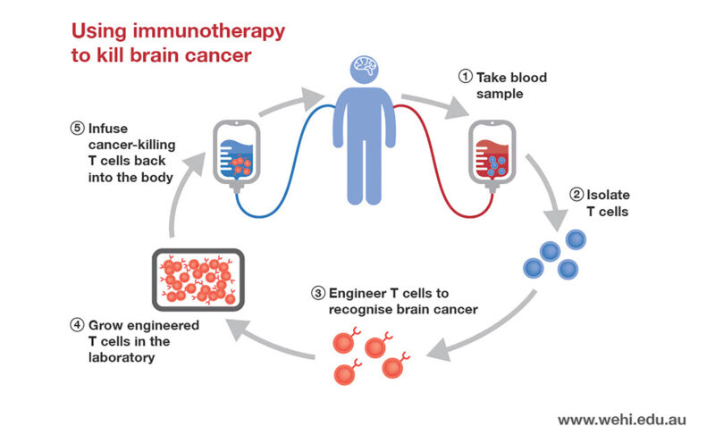 Immunotherapy inforgraphic