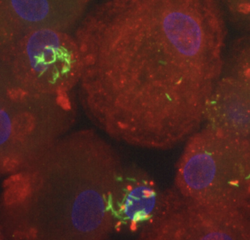 Microscope view of infected macrophages