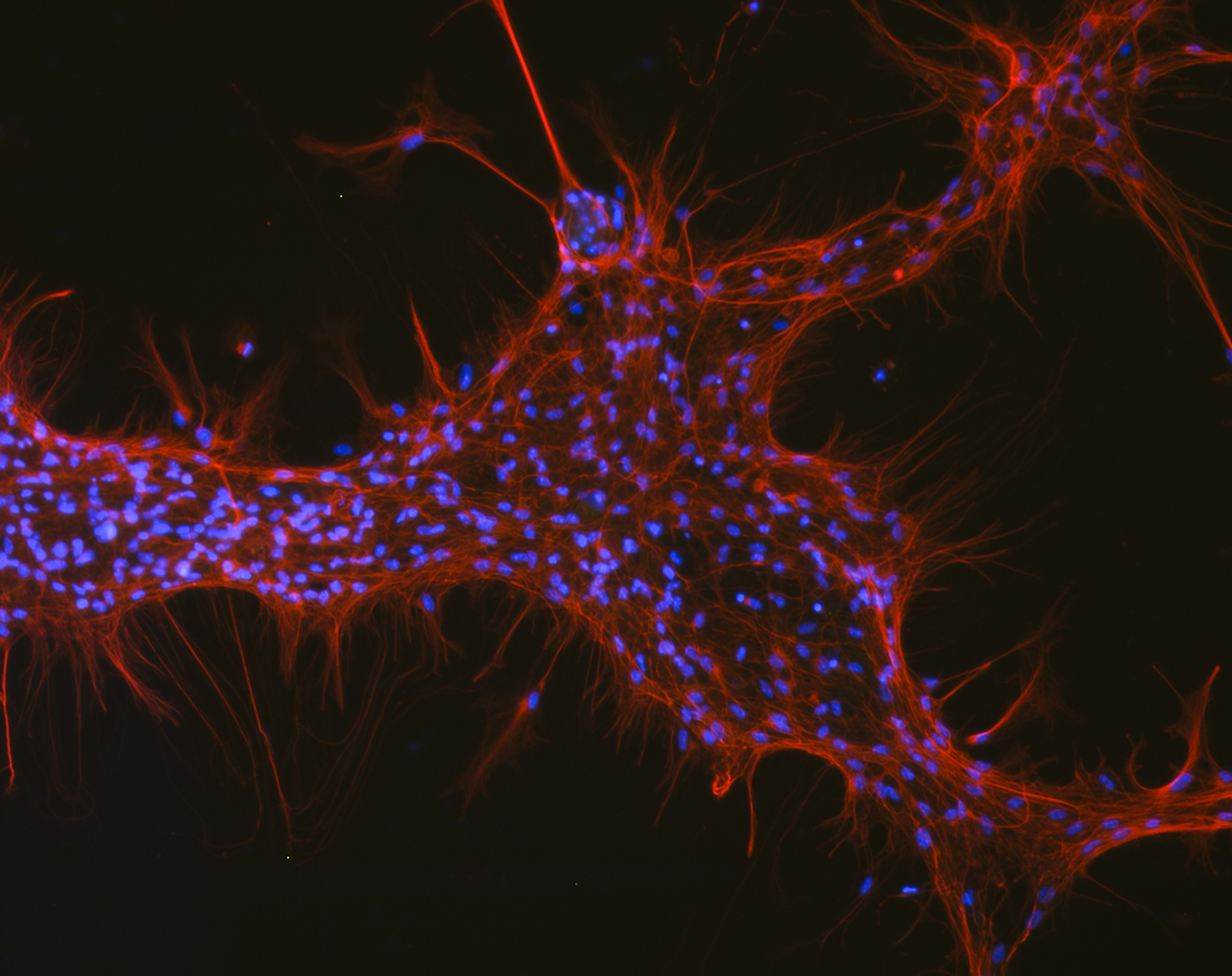 This image shows a structure of neurons in red with their nuclei in blue.