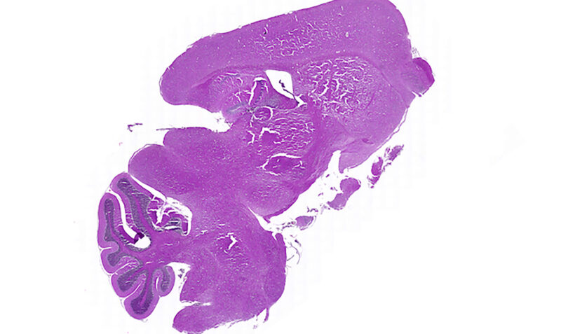 Purple tissue sample under microscope