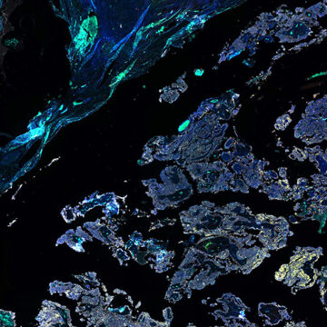 microscope image of Immune cells