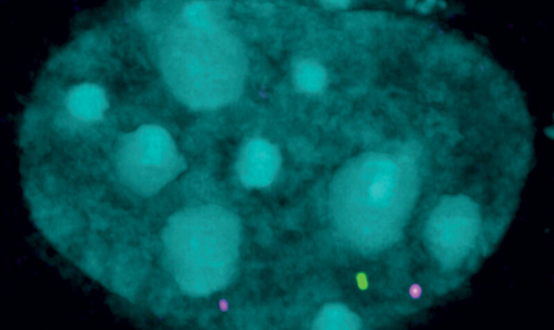 Microscope image of schmd1 protein