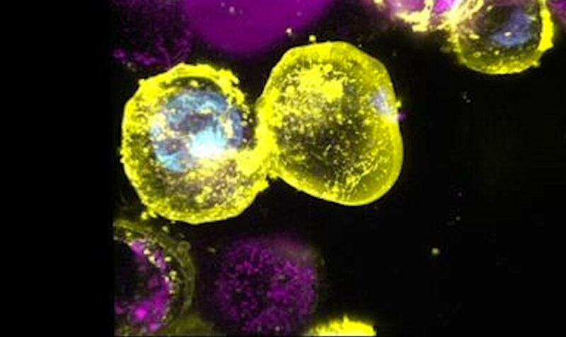 Cells dying by necroptosis, an inflammatory form of cell death which is driven by the protein MLKL. Credit: WEHI