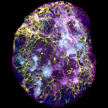 A colourful image of immune cells captured by a high-powered microscope