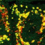 This image shows a mutated form of PINK1 was needed to allow KTP to bind. The red colour marks out the mitochondria and the green colour is a marker showing that mitochondrial clean-up is taking place.