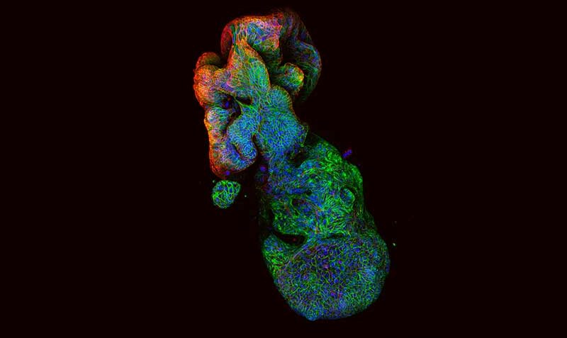 Pictured: A 3D structure of an organoid formed from human bowel cancer cells. Blue marks the nucleus of the individual cell, green is a protein that sticks each cell together and red shows the cancer cells’ orientation. Credit: WEHI