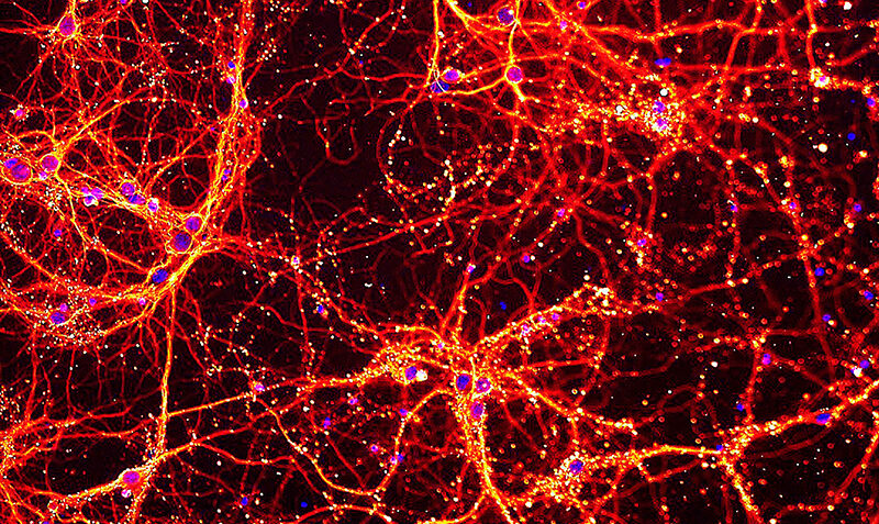 This image shows neurons and their connections to each other in red and yellow, and the cell’s DNA in blue. WEHI researchers have, for the first time, uncovered the Trabid protein’s critical role in the development of healthy neurons, which are essential for the proper functioning of our nervous system and overall quality of life. Credit: Simone Seizova and Shiraz Tyebji, WEHI