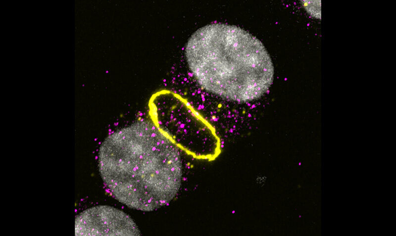 Cells dying by necroptosis, an inflammatory form of cell death. Credit: WEHI.