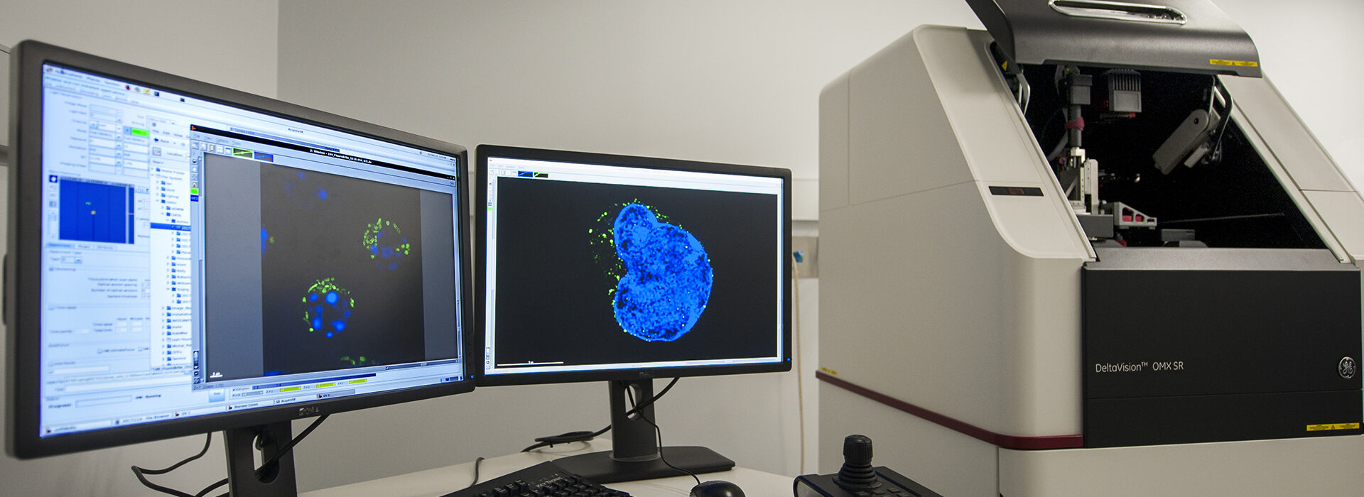 Deltavision OMX microscope at WEHI