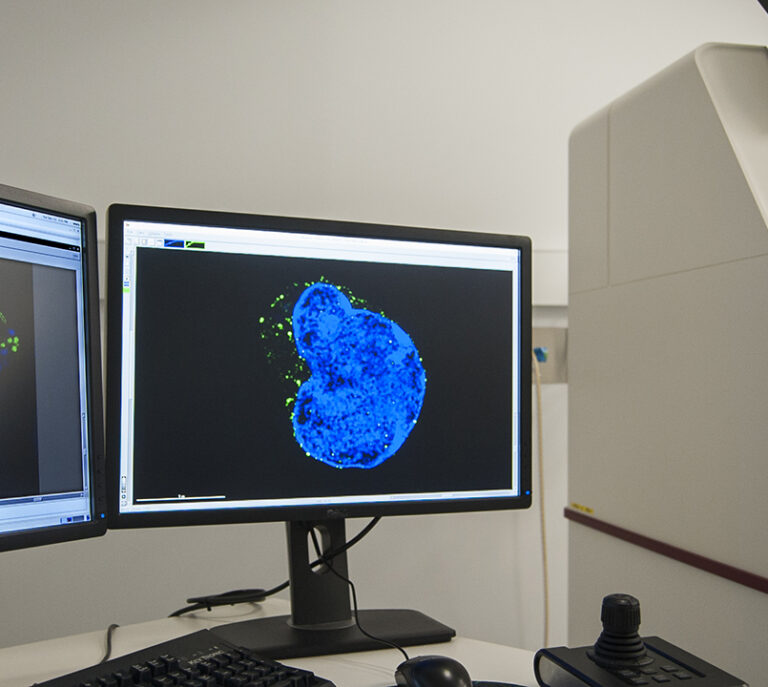 Deltavision OMX microscope at WEHI