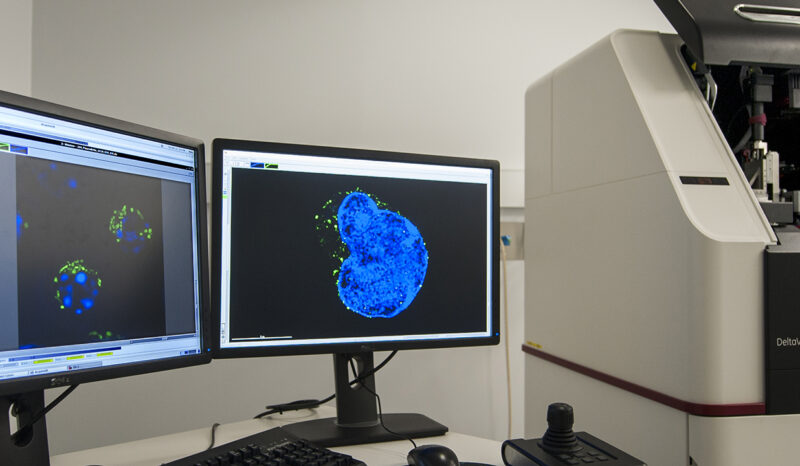Deltavision OMX microscope at WEHI