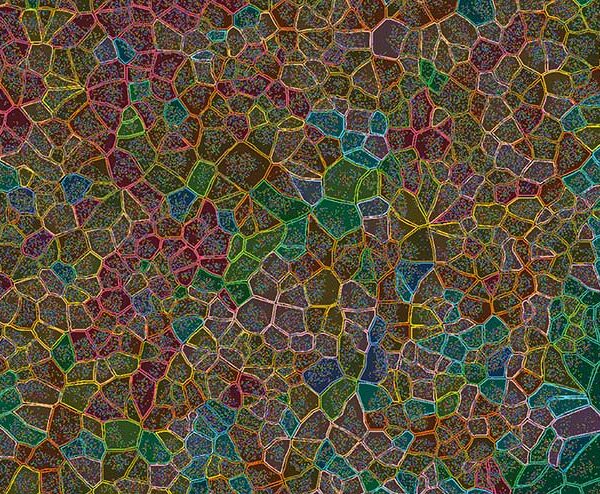 Xenium, the first to be installed in Australia, is a cutting-edge spatial omics instrument at WEHI. By visualising millions of gene products and applying bioinformatics analysis, cell types can be colour-coded for deeper exploration of tissue, like cancer's cellular and molecular makeup.