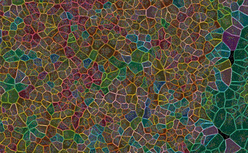 Xenium, the first to be installed in Australia, is a cutting-edge spatial omics instrument at WEHI. By visualising millions of gene products and applying bioinformatics analysis, cell types can be colour-coded for deeper exploration of tissue, like cancer's cellular and molecular makeup.