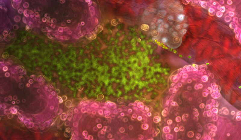 A visualisation of the malaria parasite, shown inside an infected liver cell