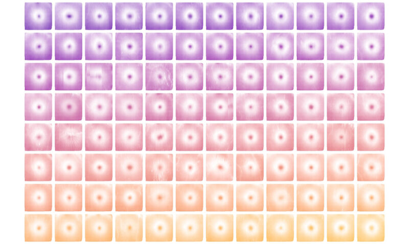 Multiple retinal maps of single eyes with white indicating where the retina is thickest and coloured areas representing thinner regions of the retina. The research identified 294 genes influencing the contours of these retinal maps and pinpointed specific areas of the maps linked to disease.