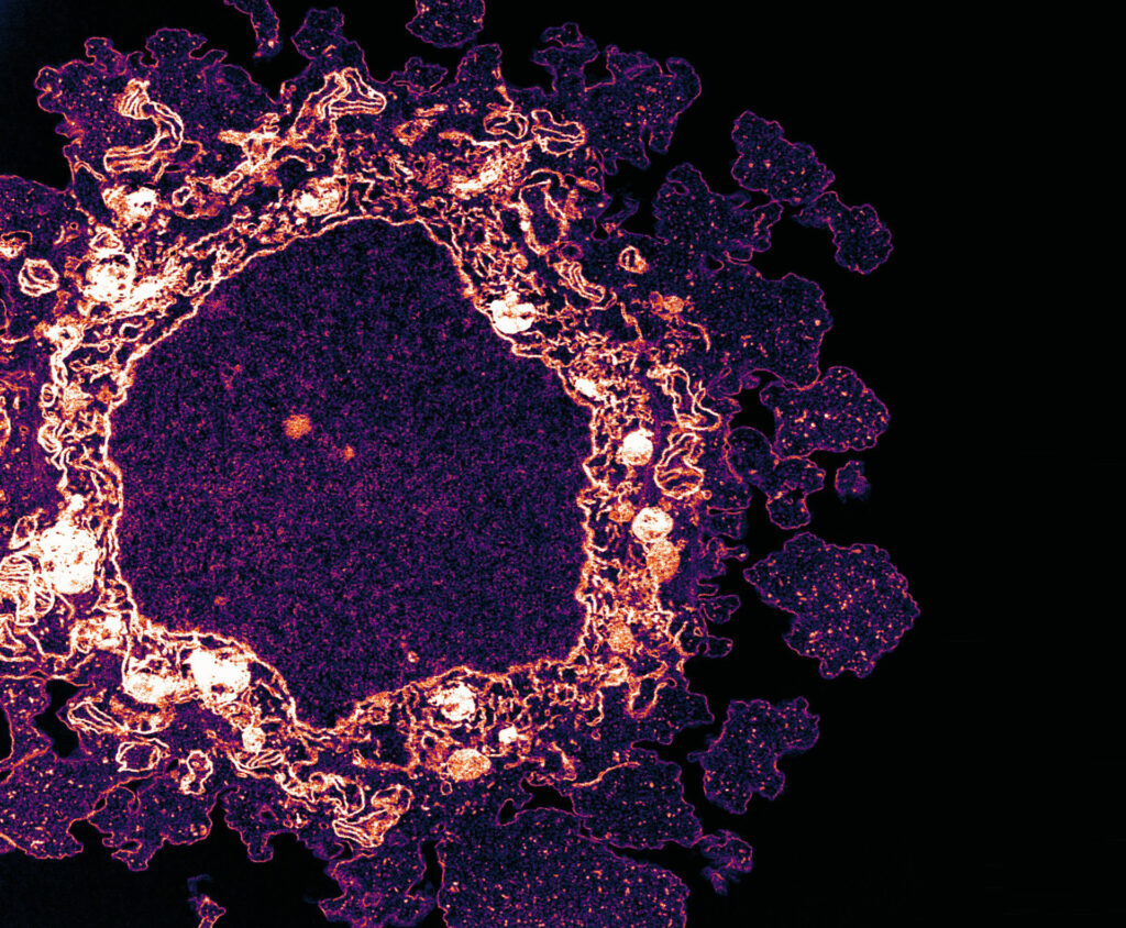 Art of Science: The Ring of Fire | WEHI