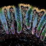 Image taken through spatial transcriptomics showing patterns of cell death-related genes in gut tissue