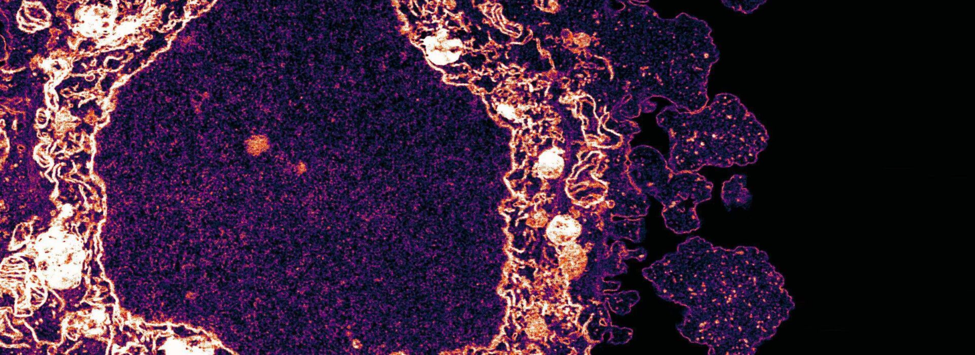 Visualisation of a HeLa cell captured under a microscope