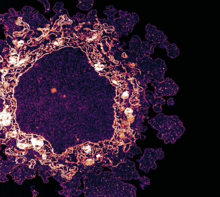 Visualisation of a HeLa cell captured under a microscope
